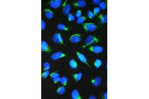 IF analysis of CCT7 using anti-CCT7 antibody (ABIN5692966).