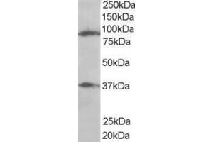 Western Blotting (WB) image for anti-ELKS/RAB6-Interacting/CAST Family Member 1 (ERC1) (N-Term) antibody (ABIN2465645) (ERC1 antibody  (N-Term))