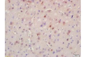 Formalin-fixed and paraffin embedded rat brain labeled with Rabbit Anti-BRD8 Polyclonal Antibody, Unconjugated (ABIN716951) at 1:200 followed by conjugation to the secondary antibody and DAB staining (BRD8 antibody  (AA 331-430))