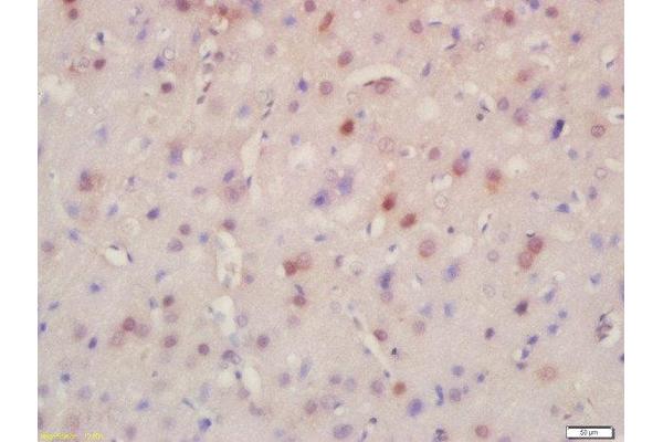BRD8 antibody  (AA 331-430)