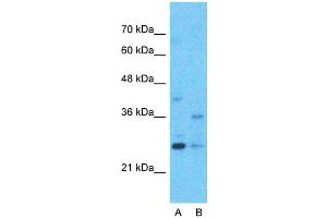 Host:  Rabbit  Target Name:  M96  Sample Type:  Hela  Lane A:  Primary Antibody  Lane B:  Primary Antibody + Blocking Peptide  Primary Antibody Concentration:  1ug/ml  Peptide Concentration:  5ug/ml  Lysate Quantity:  25ug/lane/lane  Gel Concentration:  0.