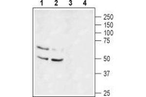 Western blot analysis of rat brain lysate (lanes 1 and 3) and mouse brain lysate (lanes 2 and 4): - 1,2. (KCNA1 antibody  (Extracellular))