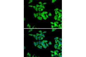 Immunofluorescence analysis of A-549 cells using NMT2 antibody (ABIN6130572, ABIN6144688, ABIN6144690 and ABIN6222825). (NMT2 antibody  (AA 1-120))