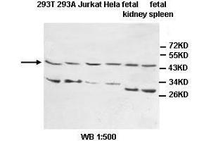 Image no. 1 for anti-Interleukin 1 Receptor, Type II (IL1R2) antibody (ABIN1577241) (IL1R2 antibody)