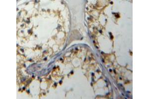 Used in DAB staining on fromalin fixed paraffin-embedded testis tissue (IL5RA antibody  (AA 42-182))