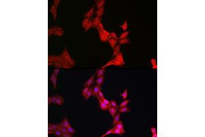 Immunofluorescence analysis of PC-12 cells using Glucocorticoid Receptor Rabbit pAb (ABIN3023090, ABIN3023091, ABIN3023092, ABIN1513281 and ABIN6219384) at dilution of 1:200 (40x lens). (Glucocorticoid Receptor antibody  (AA 1-280))