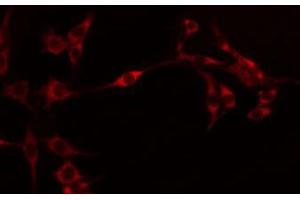 ABIN6274595 staining Hela by IF/ICC. (OB Cadherin antibody  (Internal Region))