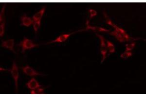 ABIN6274595 staining Hela by IF/ICC. (OB Cadherin antibody  (Internal Region))