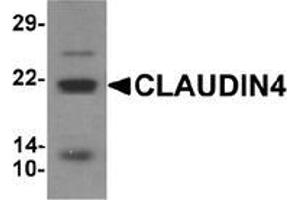 Western blot analysis of CLAUDIN4 in human colon tissue lysate with CLAUDIN4 Antibody  at 1 μg/ml. (Claudin 4 antibody  (C-Term))