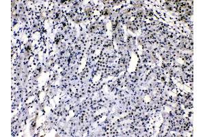 Immunohistochemistry (IHC) image for anti-Heterogeneous Nuclear Ribonucleoprotein A1 (HNRNPA1) (AA 8-42), (N-Term) antibody (ABIN4886621)