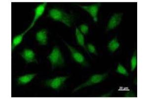 Immunostaining analysis in HeLa cells. (ACIN1 antibody)