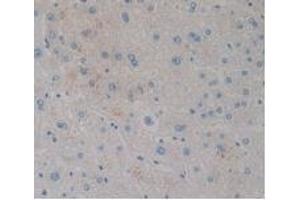 Detection of CCK8 in Human Liver Tissue using Monoclonal Antibody to Cholecystokinin 8 (CCK8) (CCK8 antibody)