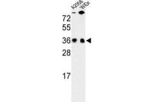 Western Blotting (WB) image for anti-serine/arginine-Rich Splicing Factor 1 (SRSF1) antibody (ABIN3002837) (SRSF1 antibody)