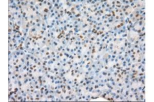 Immunohistochemical staining of paraffin-embedded liver tissue using anti-H6PD mouse monoclonal antibody. (Glucose-6-Phosphate Dehydrogenase antibody)