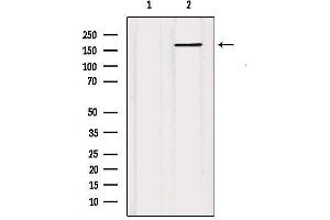 Western blot analysis of extracts from HUVEC, using ABCC5  Antibody. (ABCC5 antibody  (N-Term))