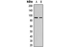 Western blot analysis of SP1 (pT453) expression in Jurkat (A), mouse melanoma cancer (B) whole cell lysates. (SP1 antibody  (pSer453))