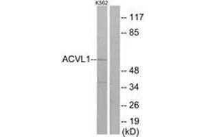 Western blot analysis of extracts from K562 cells, using ACVL1 Antibody. (ACVRL1 antibody  (AA 196-245))