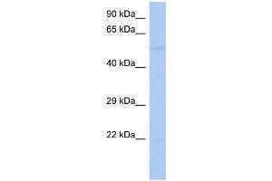 WB Suggested Anti-RIPK3 Antibody Titration:  0. (RIPK3 antibody  (Middle Region))