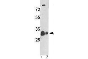 Western blot analysis of VDAC antibody and 1) human A375 cell line and 2) mouse heart tissue lysate.
