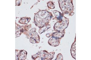 Immunohistochemistry of paraffin-embedded human placenta using RPS13 antibody (ABIN7270012) at dilution of 1:100 (40x lens). (RPS13 antibody  (AA 79-151))