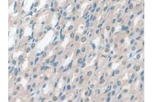 DAB staining on IHC-P; Samples: Rat Stomach Tissue (GSTM4 antibody  (AA 21-215))