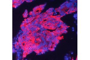 IF analysis of Cytokeratin 19 using anti-Cytokeratin 19 antibody (ABIN5693023).