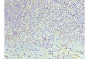 Immunohistochemistry of paraffin-embedded human tonsil tissue using ABIN7150339 at dilution of 1:100 (MCM6 antibody  (AA 562-821))