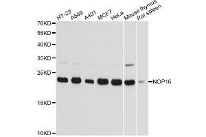 Western blot analysis of extracts of various cell lines, using NOP16 antibody. (NOP16 antibody)