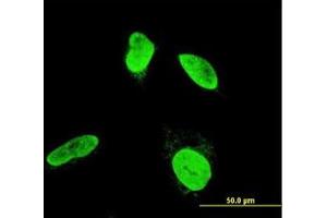 Image no. 3 for anti-Testis-Specific Kinase 2 (TESK2) (AA 405-542) antibody (ABIN599135) (TESK2 antibody  (AA 405-542))