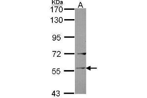 WB Image Sample (30 ug of whole cell lysate) A: Raji 7. (Ladinin 1 antibody  (C-Term))