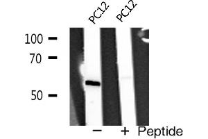 Western blot analysis of TRAF2 expression in PC12 cells