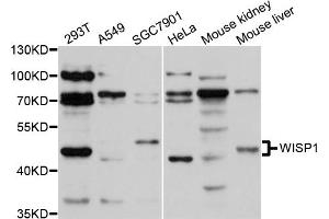 Western blot analysis of extracts of various cell lines, using WISP1 antibody (ABIN5971727) at 1/1000 dilution. (WISP1 antibody)