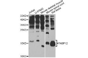Western blot analysis of extracts of various cell lines, using FABP12 antibody (ABIN6293282) at 1:1000 dilution.