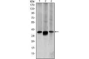 Western blot analysis using MAP2K6 mouse mAb against HepG2 (1), MCF-7 (2) and NIH/3T3 (3) cell lysate.