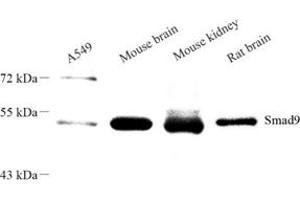 Western blot analysis of SMAD9 (ABIN7075625) at dilution of 1: 1000