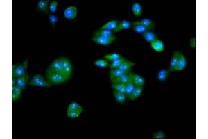 Immunofluorescence staining of PC-3 cells with ABIN7146614 at 1:133, counter-stained with DAPI. (PKIG antibody  (AA 1-76))