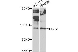 Western blot analysis of extracts of BT474 and HepG2 cells, using ECE2 antibody.