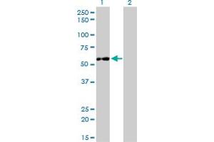 Western Blot analysis of IMPDH2 expression in transfected 293T cell line by IMPDH2 monoclonal antibody (M01), clone 1E12-B6.
