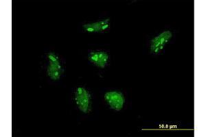 Immunofluorescence of monoclonal antibody to RPL21 on HeLa cell. (RPL21 antibody  (AA 2-85))