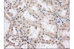Immunohistochemical staining of paraffin-embedded Human liver tissue using anti-PDE4A mouse monoclonal antibody. (PDE4A antibody)