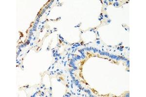 Immunohistochemistry of paraffin-embedded Rat lung using RGS5 Polyclonal Antibody at dilution of 1:100 (40x lens). (RGS5 antibody)