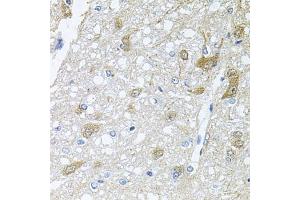 Immunohistochemistry of paraffin-embedded rat brain using RAPSN antibody (ABIN6132583, ABIN6146690, ABIN6146691 and ABIN6222434) at dilution of 1:100 (40x lens). (RAPSN antibody  (AA 1-353))