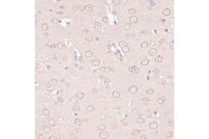 Immunohistochemistry of paraffin-embedded mouse brain using ABCF2 antibody (ABIN6291735) at dilution of 1:100 (40x lens).
