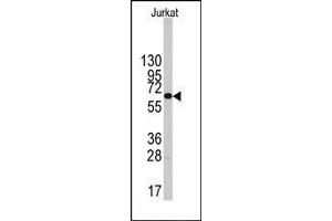Image no. 1 for anti-6-phosphofructo-2-Kinase/fructose-2,6-Biphosphatase 1 (PFKFB1) (Middle Region) antibody (ABIN360657) (PFKFB1 antibody  (Middle Region))