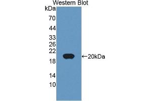 Detection of Recombinant MHCDG, Human using Polyclonal Antibody to Cluster Of Differentiation 74 (CD74) (CD74 antibody  (AA 78-222))