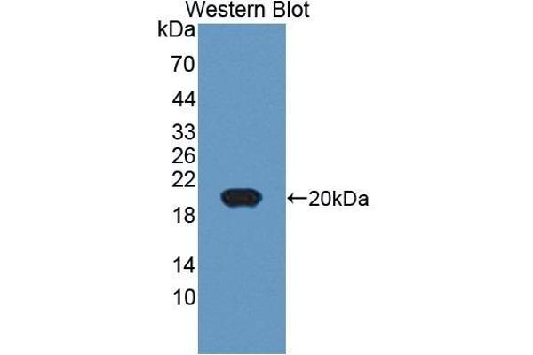 CD74 anticorps  (AA 78-222)