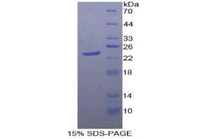SDS-PAGE analysis of Human PTPRN Protein.