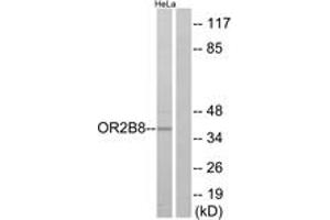 Western blot analysis of extracts from HeLa cells, using OR2B8 Antibody. (OR2B8P antibody  (AA 61-110))