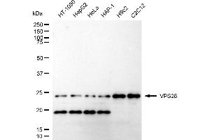 Western blotting analysis using VPS28 antibody (ABIN7800926). (Recombinant VPS28 antibody)