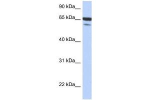 MAP3K7IP1 antibody used at 1 ug/ml to detect target protein. (TAB1 antibody  (N-Term))